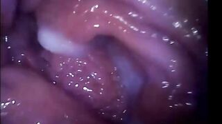 Livetopcams.com Cam Girl Orgasm Filmed From Inside Vagina