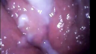 Livetopcams.com Cam Girl Orgasm Filmed From Inside Vagina